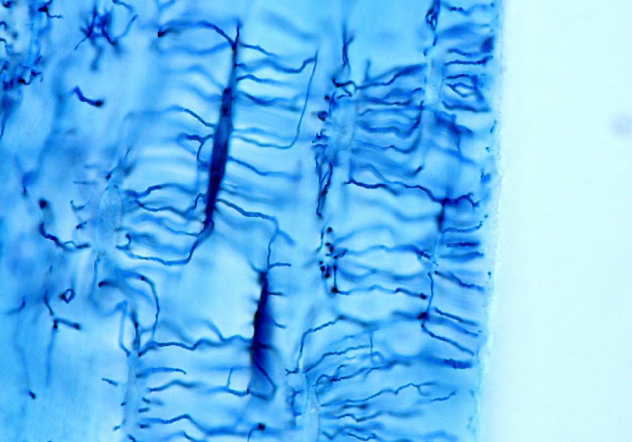 High magnification light micrograph showing osteocytes stained with the Schmorl's technique. From its elongated cell body, many thin and long processes are directed to the surface of the bone trabeculae.
